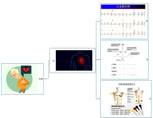 ECG monitor solution